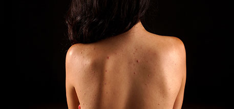 Lumps, Bumps, and Other Skin Conditions